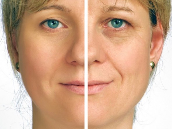 7 Natural Tips to Reduce Lines and Wrinkles