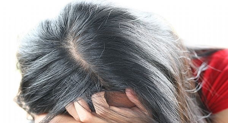 Common Hair problems in Women & Nutrient Rich Remedies